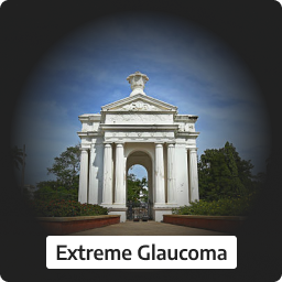 Extreme Glaucoma