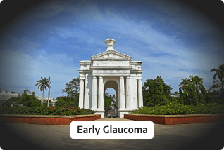 Early Glaucoma