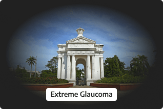 Extreme Glaucoma