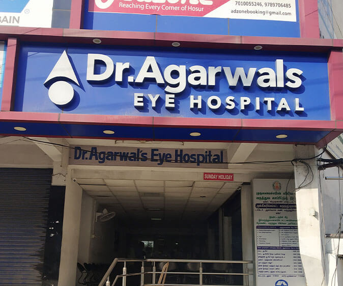 Best Eye Hospital Near Me in Hosur, Tamilnadu | Book Appointment Online