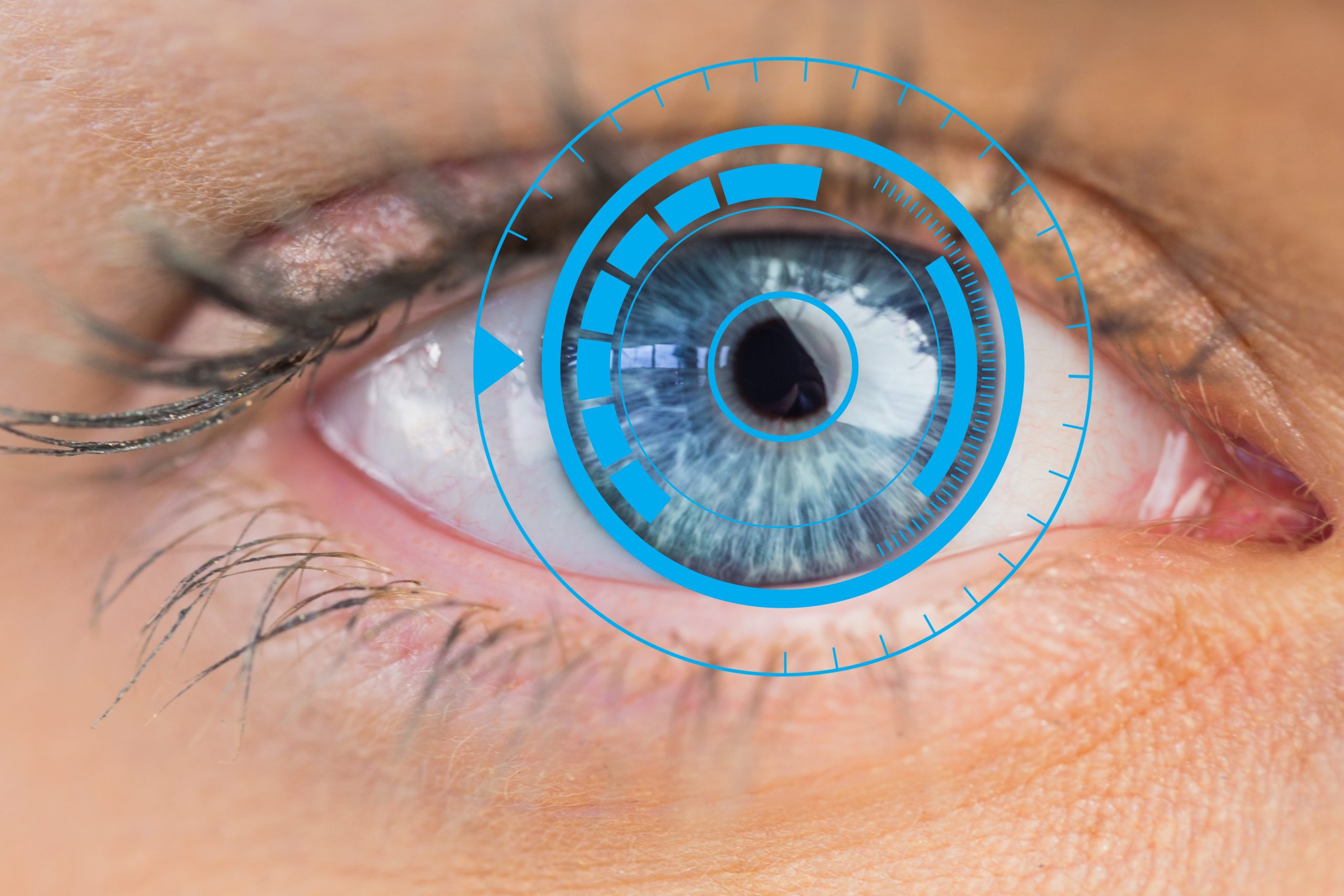 What is the recovery time after cataract surgery - Dr. Agarwal