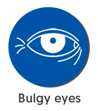 Bulgy eyes