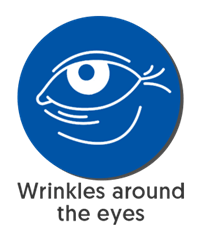 Wrinkles around the eyes