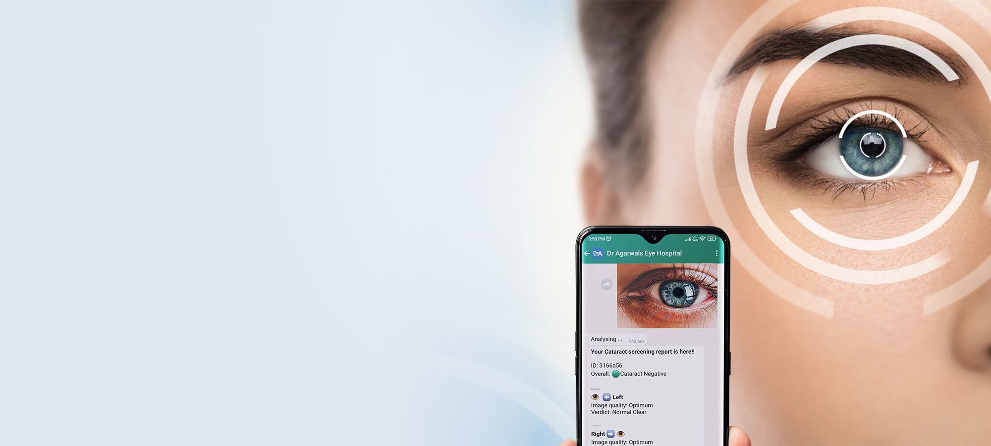 cataract website