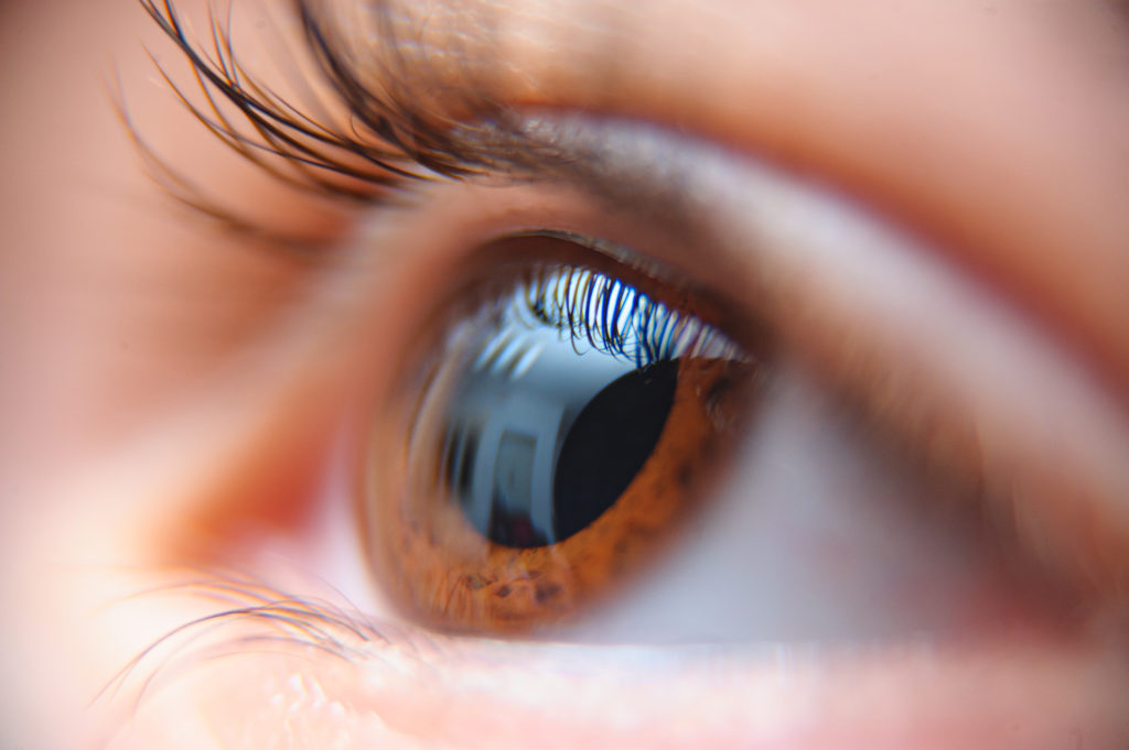 Nasal Pterygium