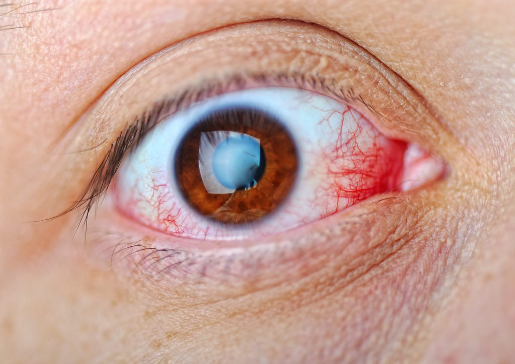 Eye, macro, blood