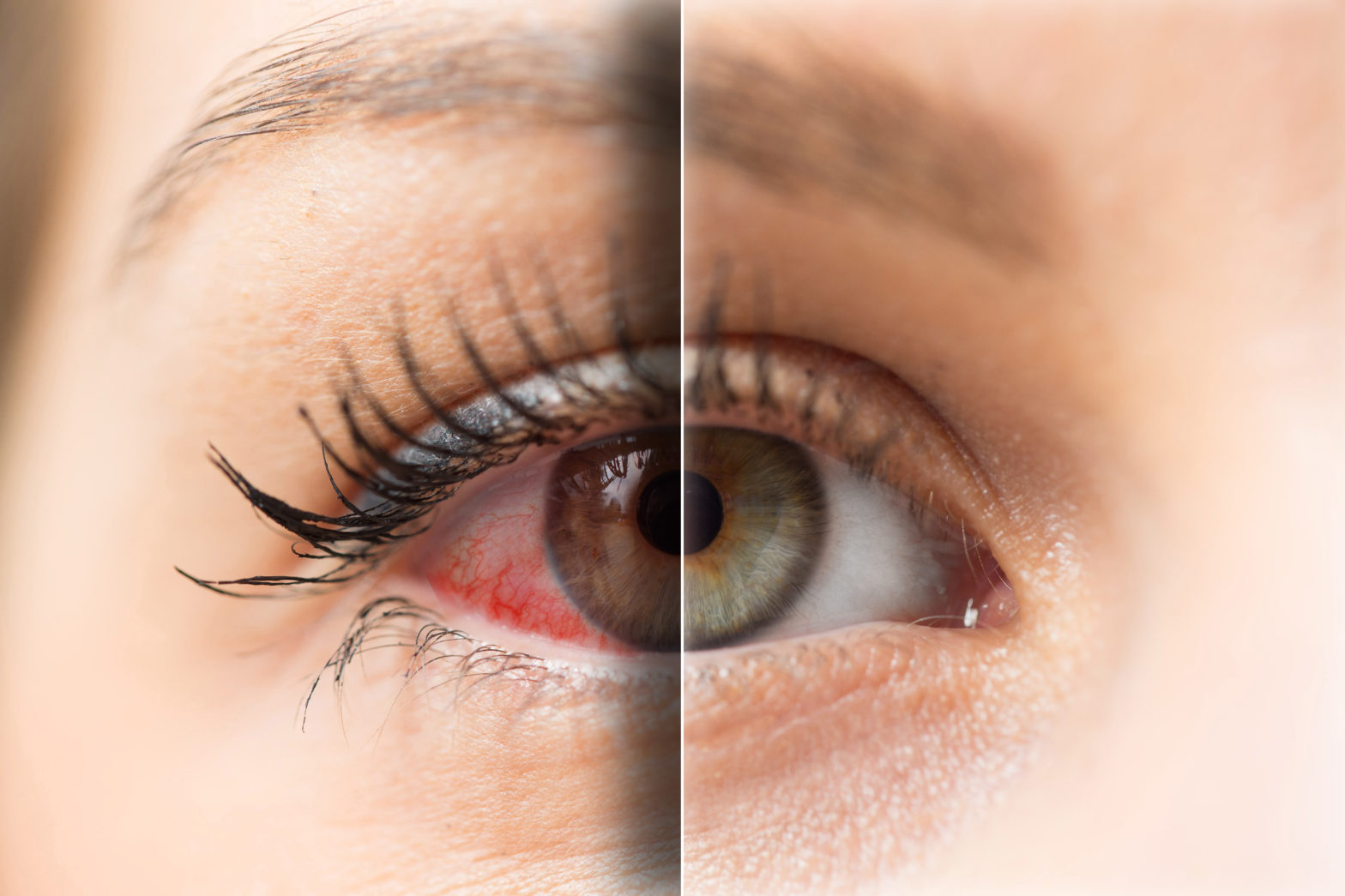 Understanding the Early Warning Signs and Symptoms of Glaucoma