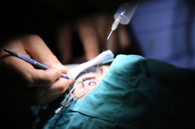 MICS Cataract Surgery