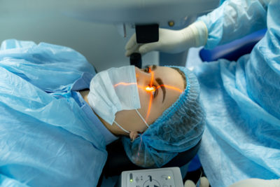 Laser Iridotomy for Glaucoma