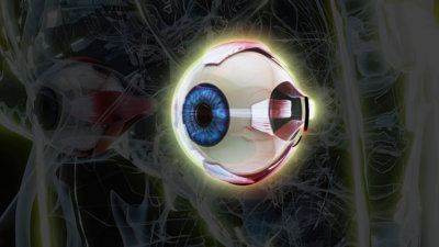 Keratoconus Myths and Facts