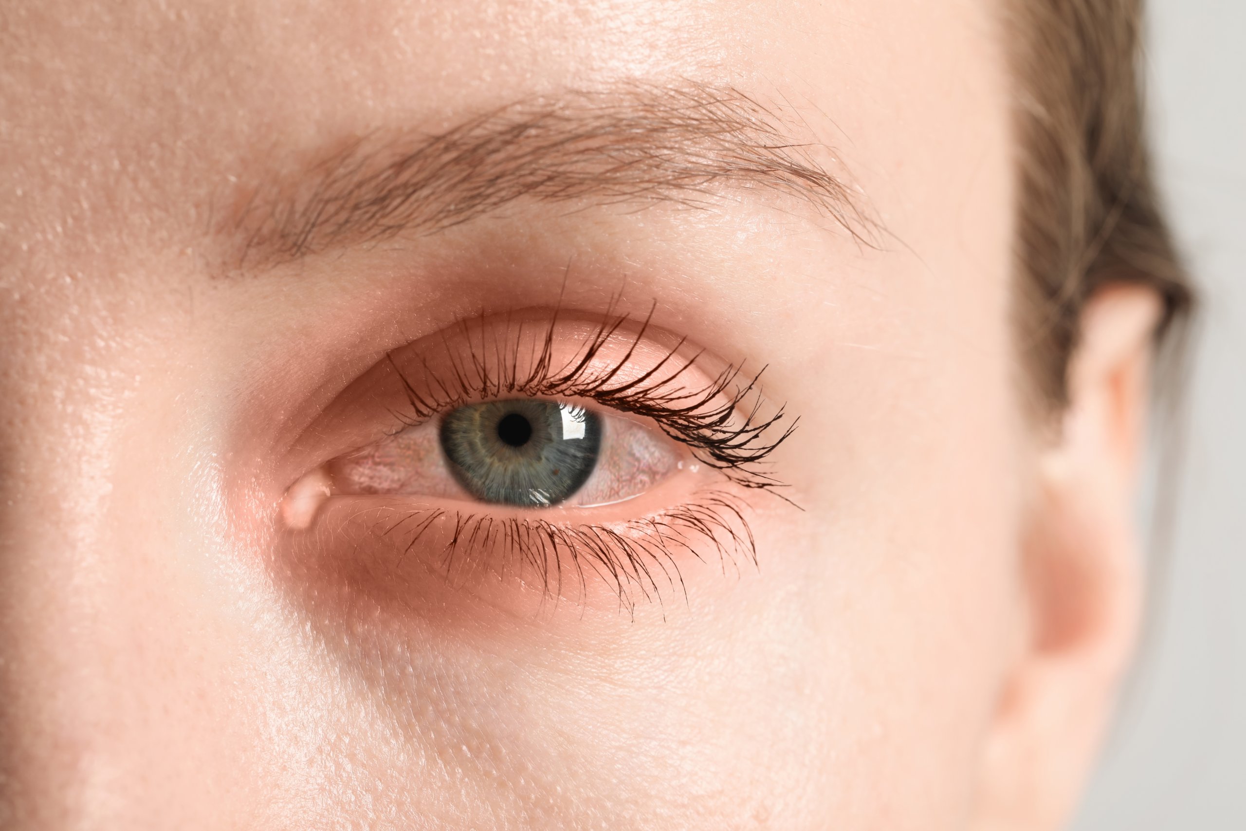 Bacterial Conjunctivitis Treatment