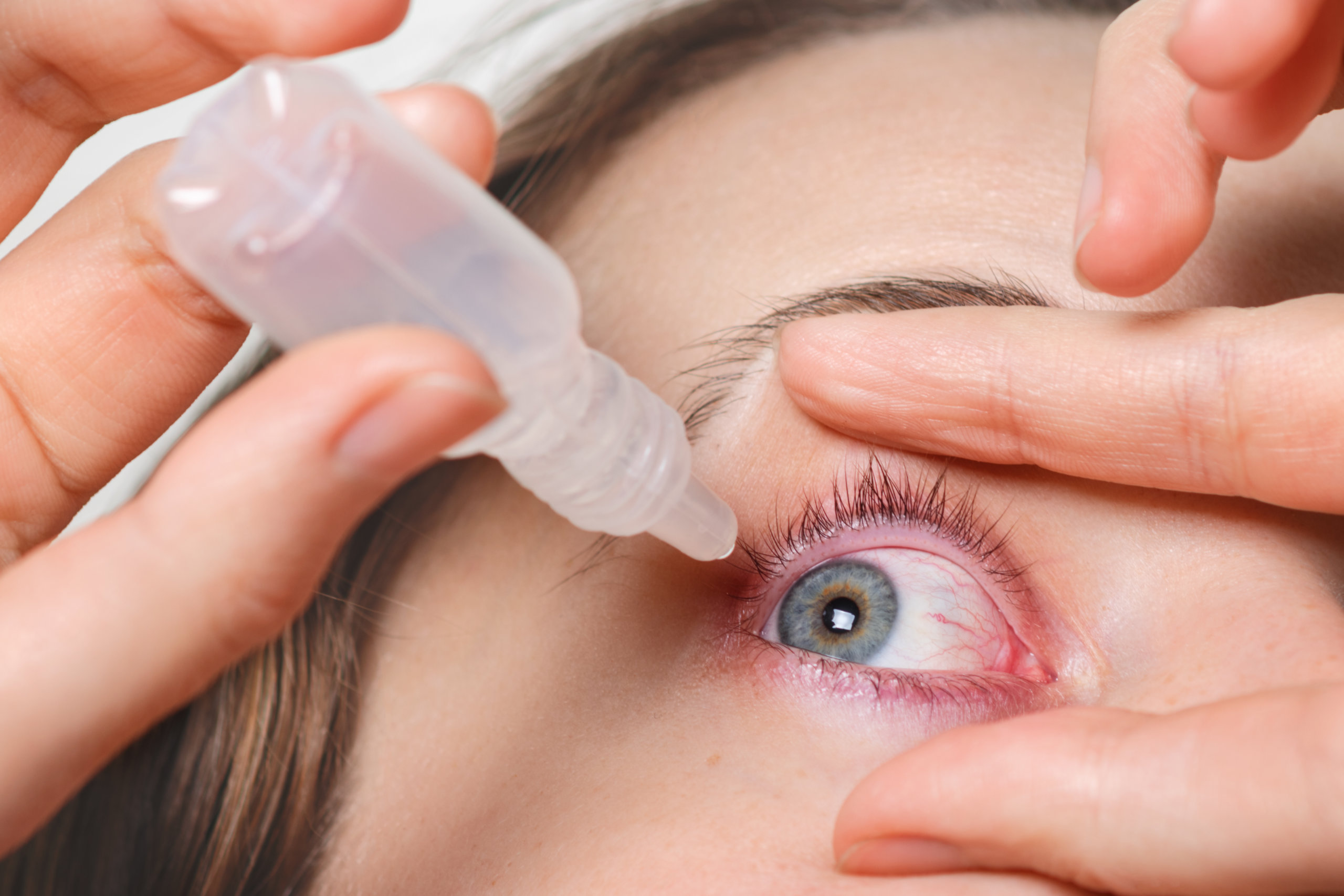 Eye Drops for Irritated Eyes